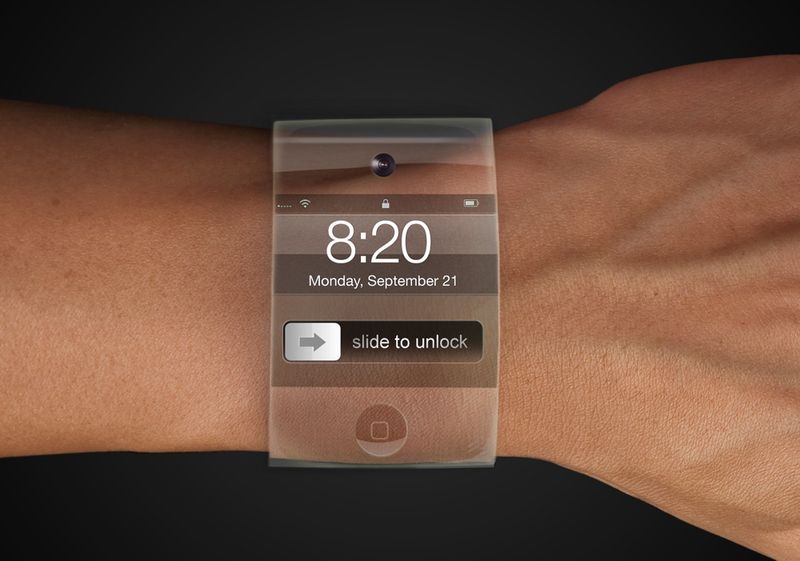 iPhone Wrist (Yrving Torrealba 002)